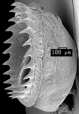 SEM_photograph_of_a_large_dactylus_sucker.